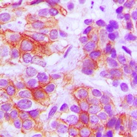 Frizzled 5 Rabbit Polyclonal Antibody