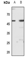 ZIP7 Rabbit Polyclonal Antibody