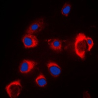 ZIP7 Rabbit Polyclonal Antibody