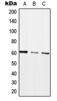 ARHGEF5 Rabbit Polyclonal Antibody