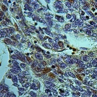 ARHGEF5 Rabbit Polyclonal Antibody
