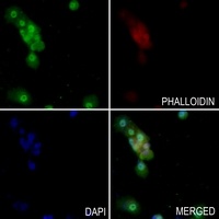 ARHGEF5 Rabbit Polyclonal Antibody