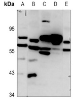 Frizzled 8 Rabbit Polyclonal Antibody
