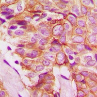 Frizzled 8 Rabbit Polyclonal Antibody