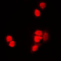 Histone H3 (Acetyl-K9) Rabbit Polyclonal Antibody