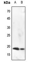 Histone H3 (Phospho-S10) Rabbit Polyclonal Antibody