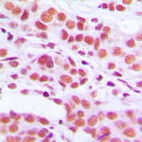 Histone H3 (Phospho-S10) Rabbit Polyclonal Antibody