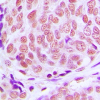 KLF11 Rabbit Polyclonal Antibody