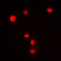 KLF11 Rabbit Polyclonal Antibody