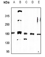MRCK alpha Rabbit Polyclonal Antibody