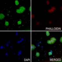 MRCK alpha Rabbit Polyclonal Antibody