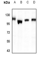 PPFIBP1 Rabbit Polyclonal Antibody