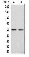 Cytochrome P450 4F2 Rabbit Polyclonal Antibody