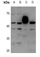 COPS3 Rabbit Polyclonal Antibody