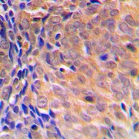 COPS3 Rabbit Polyclonal Antibody