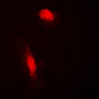 COPS3 Rabbit Polyclonal Antibody