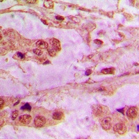 API5 Rabbit Polyclonal Antibody