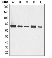p63 Rabbit Polyclonal Antibody