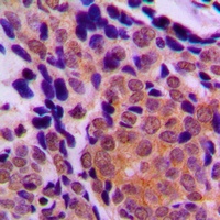 p63 Rabbit Polyclonal Antibody