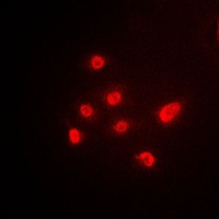 p63 Rabbit Polyclonal Antibody