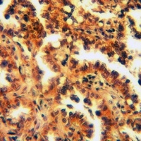 B3GALT4 Rabbit Polyclonal Antibody