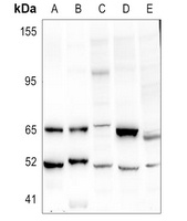 URI1 Rabbit Polyclonal Antibody