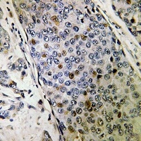 URI1 Rabbit Polyclonal Antibody