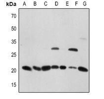 CD256 Rabbit Polyclonal Antibody
