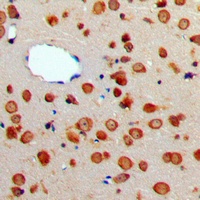 CD256 Rabbit Polyclonal Antibody