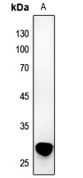 TWEAK Rabbit Polyclonal Antibody