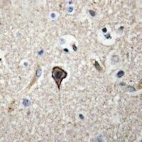 TWEAK Rabbit Polyclonal Antibody