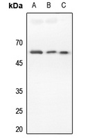 DR4 Rabbit Polyclonal Antibody