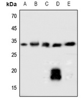 SOCS2 Rabbit Polyclonal Antibody