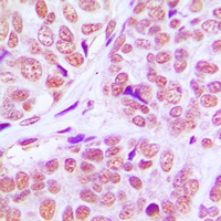 PCAF Rabbit Polyclonal Antibody