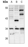 CDK5R1 p35 Rabbit Polyclonal Antibody