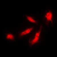 CDK5R1 p35 Rabbit Polyclonal Antibody