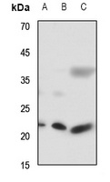 RAB7L1 Rabbit Polyclonal Antibody