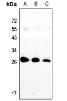 Nop30 Rabbit Polyclonal Antibody