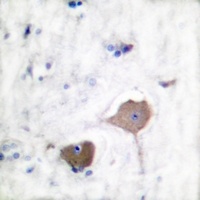 Nop30 Rabbit Polyclonal Antibody