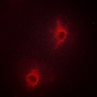 Nop30 Rabbit Polyclonal Antibody