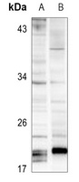 SOCS3 Rabbit Polyclonal Antibody