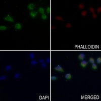 SOCS3 Rabbit Polyclonal Antibody