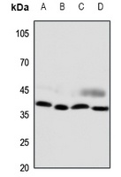 CCRL2 Rabbit Polyclonal Antibody