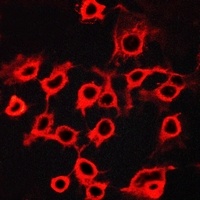 CCRL2 Rabbit Polyclonal Antibody