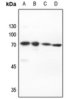 PIAS2 Rabbit Polyclonal Antibody