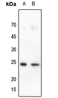 Claudin 10 Rabbit Polyclonal Antibody