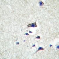 Claudin 10 Rabbit Polyclonal Antibody