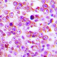 Claudin 2 Rabbit Polyclonal Antibody