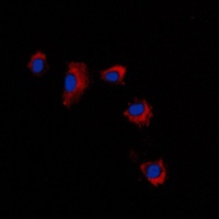 Claudin 2 Rabbit Polyclonal Antibody