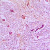 TBX15/18 Rabbit Polyclonal Antibody
